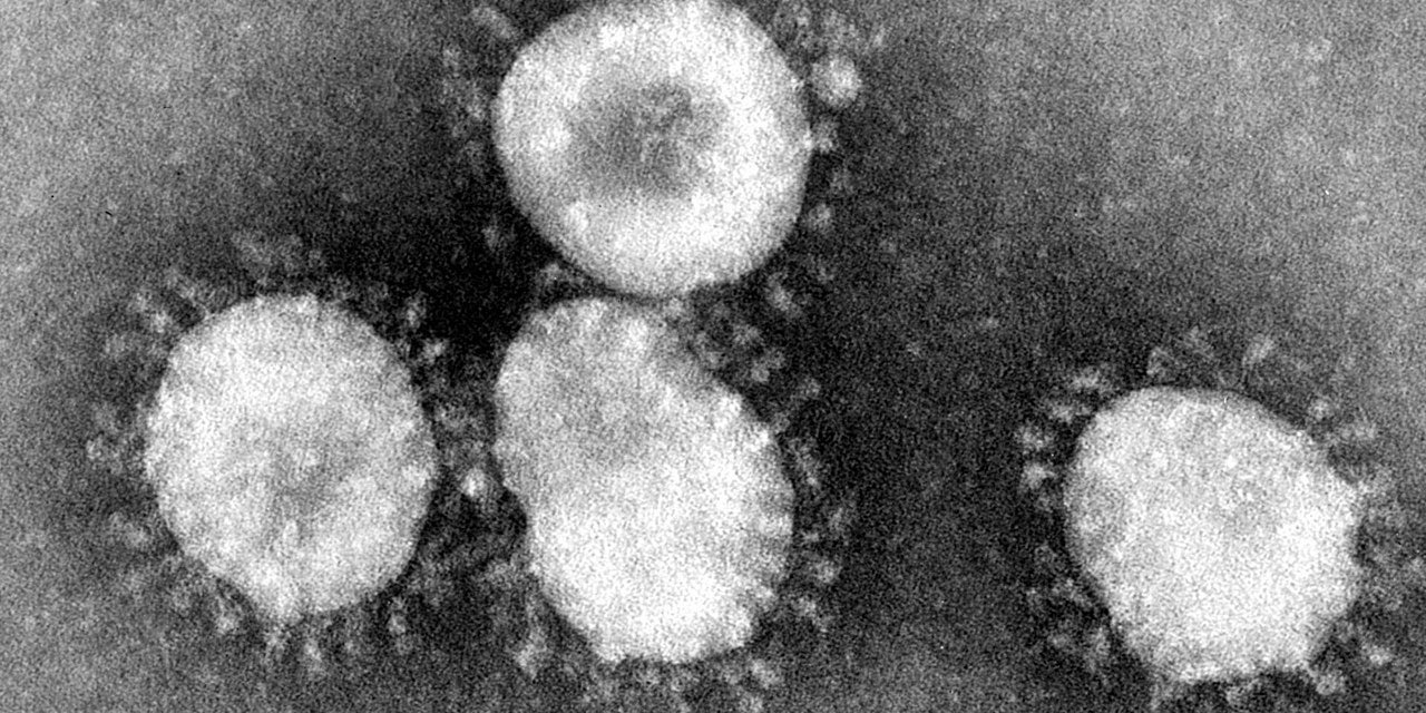 Coronavirus: Sudan on high alert